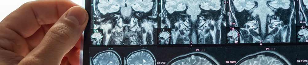 Examining xrays of a head, the brain and neck. 